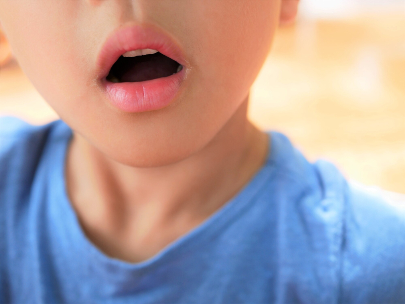 お口ぽかん・口腔機能発達不全症のイメージ